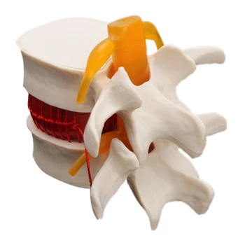 Žmogaus Anatomija Skeletas Stuburo Juosmens Disko Herniation Mokymo Modelį Kaukolės Smegenų Traumos Mokykliniai Reikmenys Instrume